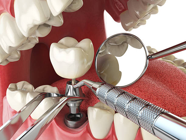 Best Emergency Dental Surgery in Waco, TX